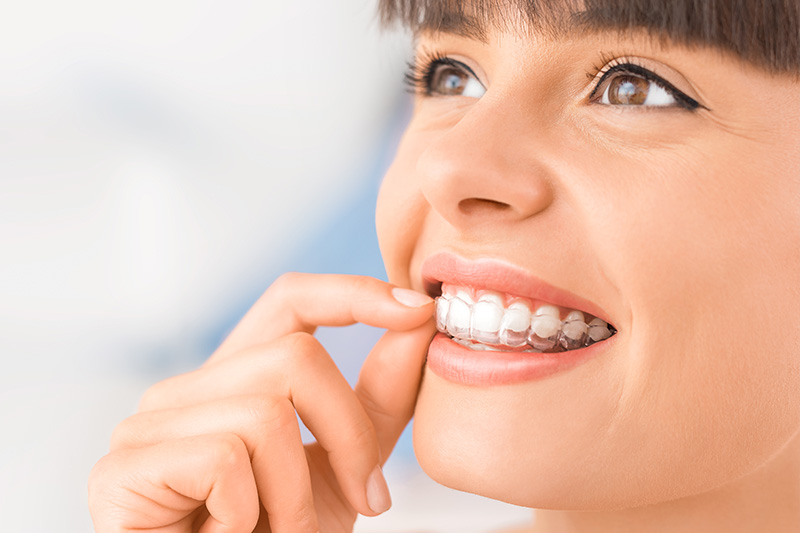 Invisalign in Norwalk